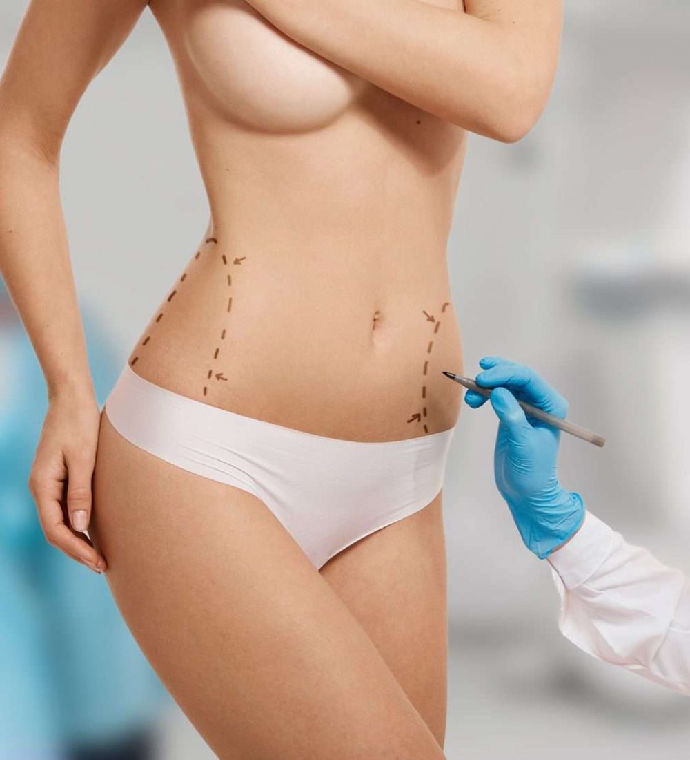 foto-cirurgia-plastica-corporal