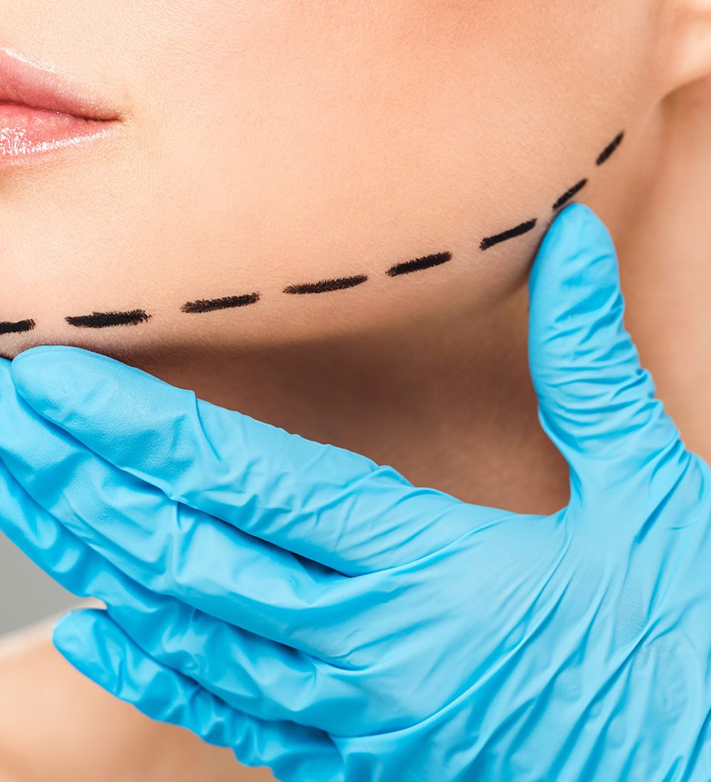 foto-cirurgia-plastica-facial4